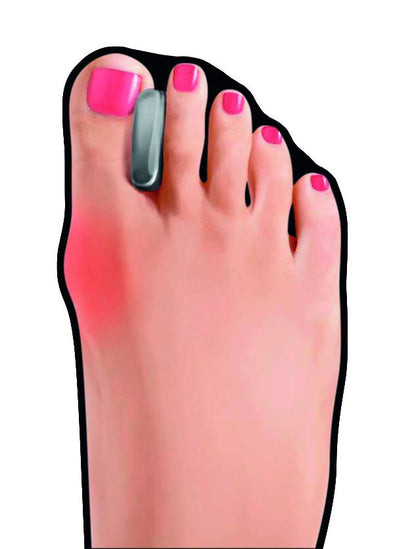 GoBunion Hallux Füßlinge