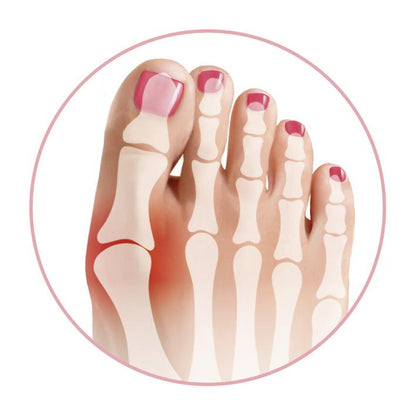 GoBunion Hallux Füßlinge